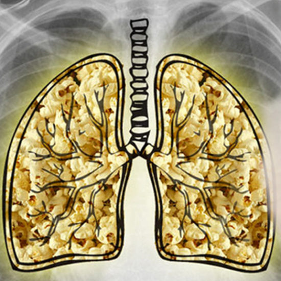 Vaping Diacetyl and Popcorn Lungs What is the Truth? VapesFlavors